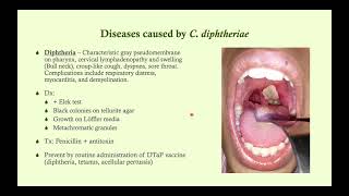 Corynebacterium diphtheriae Diphtheria  Microbiology Boot Camp [upl. by Keheley]