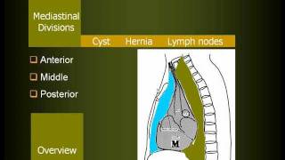 Radiology of Mediastinal lesions in Arabic [upl. by Mariellen]