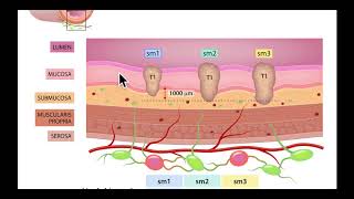 Colonoscopy Colon wall anatomy for EMR and ESD  Medical Illustration [upl. by Boggs]