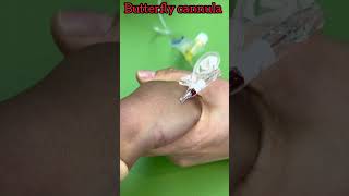 butterfly cannula kaise lagate hain shots shorts trending [upl. by Amsa]