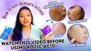 How to use KOJIC ACID to cure HyperPigmentation amp Acne marks  Best Kojic acid Serum  Sneha Reviews [upl. by Atnohs242]