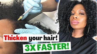 Best Way To Thicken Your Hair 3X FASTER [upl. by Gaughan]