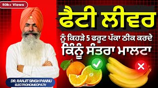 Fatty Liver इन लक्षणों पर ध्यान दे  Fatty Liver Treatment By Dr Ranjit Singh Pannu [upl. by Kori427]