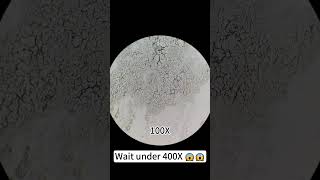 Pimples at 400X magnification are really cool underthemicroscope beefcut scienceshorts [upl. by Nived]