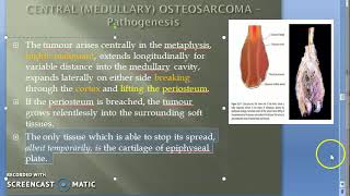 Pathology 828 c OsteoSarcoma Pathogenesis Clinical Metaphysis Bone ALP Sunburst Pattern Codman [upl. by Adnaral]