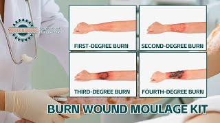 Adhesive Burn Wound Moulages 1st4th Degree Skin Burn [upl. by Thomas235]