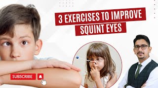 How To Fix Squint Eyes  Squint Eyes Meaning  Squint Eyes Treatment [upl. by Alwitt491]