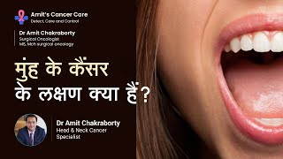 मुंह के कैंसर के लक्षण क्या हैं  What are the Symptoms of Mouth Cancer  Dr Amit Chakraborty [upl. by Nothsa472]