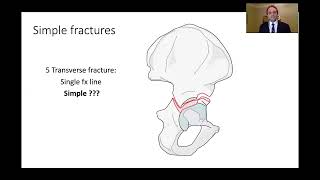 Kasr Al Ainy Postgraduate Orthopaedic Review Course  Acetabular Fractures Principles of Management [upl. by Polloch]