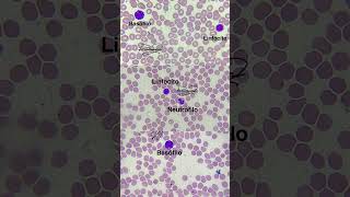 Morfología de leucocitos hematologia laboratorioclínico qfb [upl. by Waldack]