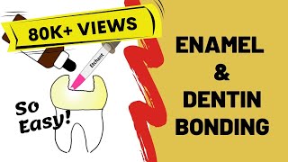 Enamel and Dentin Bonding Simplified [upl. by Aleta]