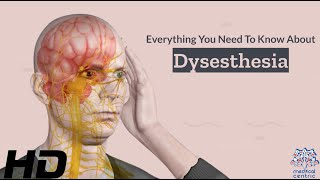 Dysesthesia 101 A Comprehensive Guide to this Mysterious Condition [upl. by Chiarra]