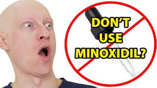 Why I Hate Topical Minoxidil Rogaine [upl. by Formica]