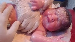 New born baby cleaning removed vernix baby oil is used baby need good cleaning looking so beautifull [upl. by Gnirol]