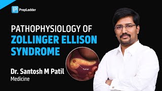 Pathophysiology of Zollinger Ellison Syndrome by Dr Santosh M Patil [upl. by Nage]