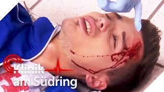 Bruder hat Gehirntumor Zufällige Schockdiagnose  FreddyFreitag  Klinik am Südring  SAT1 TV [upl. by Artima]