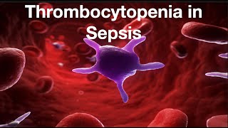 Thrombocytopenia in Sepsis [upl. by Trilby]