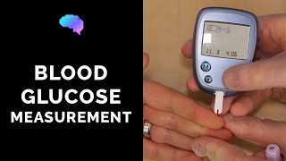 Blood Glucose Measurement  CBG  OSCE Guide  UKMLA  CPSA [upl. by Mazman52]