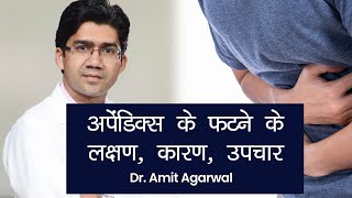 Appendix Pain Symptoms Treatment अपेंडिक्स क्या है इसके दर्द की पहचान कैसे करें कैसे करें इलाज [upl. by Haleehs]