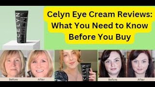 Celyn Eye Cream Reviews what you need to Know [upl. by Ronoh379]