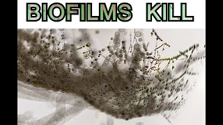 Biofilm KILLS [upl. by Kalvn]