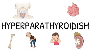 Hyperparathyroidism Primary Secondary and Tertiary  Simple and easy to understand [upl. by Ysnil658]