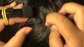 No Talking ASMR Lice Plucking amp Scalp Scratching [upl. by Ahteral]