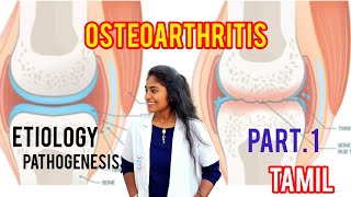 osteoarthritis  causespathophysiology clinical features part 1 in tamil [upl. by Anilok]