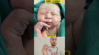 Vernix Caseosa babyborn newbornbaby newborn MRAnsari7987 cutebaby cutebabystatus viral [upl. by Kra]