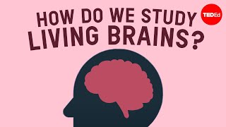 How do we safely study living brains  John Borghi and Elizabeth Waters [upl. by Aelanej]