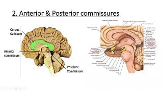 Neuroanatomy Cerebrum White Matter [upl. by Oruasi330]