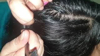 scalp check  parting using a rat tail comb [upl. by Hsevahb]