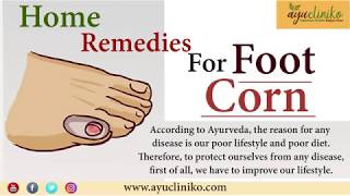 Natural Ayurvedic Home Remedies for Foot Corn and Calluses [upl. by Relyks]