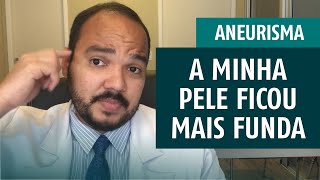 ANEURISMA CEREBRAL  A minha pele ficou mais funda após a cirurgia é normal [upl. by Noelyn]