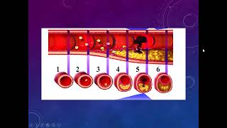 Cardiopatía isquémica II  AngioCardiología  sem 6 [upl. by Trilbee]