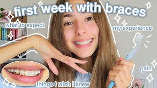 my first week with braces what to expect things i wish i knew tips etc [upl. by Ardaid]