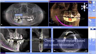 CEREC meet Galileos details en werkwijze bij Henry Schein Nederland [upl. by Nolahc]