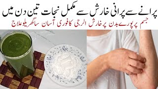 Kharish Itching Ka ilaj خارش کوجڑسےختم کرےفوری سکون اورآرام پہنچاۓ Allergi Itchy skin Relief remedy [upl. by Bucher]