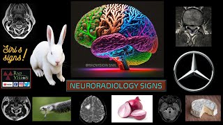 NEURORADIOLOGY SIGNS [upl. by Nive]