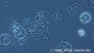 Bacterial phagocytosis by macrophage マクロファージによる細菌の貪食 [upl. by Gillmore]