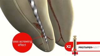 DENTSPLY ProTaper Next [upl. by Niad175]