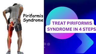 UNDERSTAND PIRIFORMIS SYNDROME  PIRIFORMIS STRETCHING EXERCISES  PIRIFORMIS STRENGTHEN and massage [upl. by Byrom]