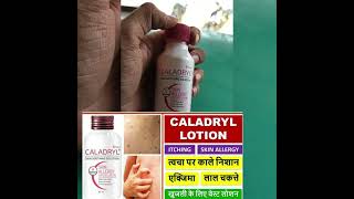 Caladryl solution  caladryl skin soothing solution how to use in hindi  caladryl solution side eff [upl. by Cargian]