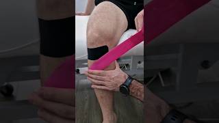 ACL taping physiotherapy knee kinesiotape [upl. by Doralia]