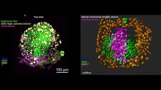 Researchers generate human embryolike structures that include extraembryonic tissue [upl. by Shalna950]