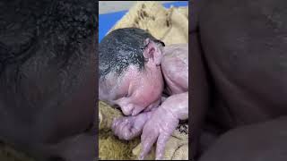 Vernix caseosaknown as vernix is the waxy white substance found coating the skin newborn human baby [upl. by Onoitna]