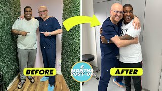 SIX MONTH ORBERA GASTRIC BALLOON TESTIMONIAL [upl. by Nico]