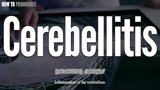 Cerebellitis Pronunciation  How to Pronounce say Cerebellitis CORRECTLY  Meaning Definition [upl. by Aillicsirp]