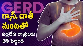 GERD Symptoms amp Treatment  Acidity Solution in Telugu [upl. by Schertz47]