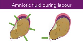 Amniotic Fluid During Labour [upl. by Akihsal]